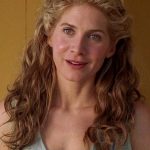 Elizabeth Mitchell Plastic Surgery Before and After