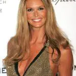 Elle Macpherson Plastic Surgery Before and After