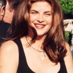 Kirstie Alley Plastic Surgery Before and After