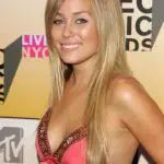 Lauren Conrad Plastic Surgery Before and After