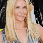Chelsea Handler Plastic Surgery Before and After