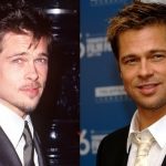 Brad Pitt Plastic Surgery Before and After