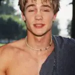 Chad Michael Murray Plastic Surgery Before and After
