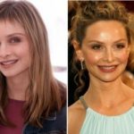 Calista Flockhart Plastic Surgery Before and After