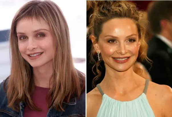 Calista flockhart before nose job