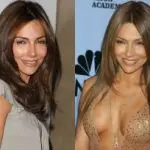 Vanessa Marcil Plastic Surgery Before and After