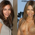 Vanessa Marcil Plastic Surgery Before and After