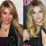 Ashley Benson Plastic Surgery Before and After
