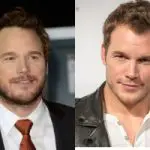 Chris Pratt Plastic Surgery Before and After