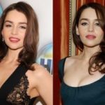 Emilia Clarke Plastic Surgery Before and After