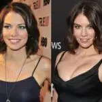 Lauren Cohan Plastic Surgery Before and After
