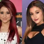 Ariana Grande Plastic Surgery Before and After