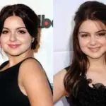 Ariel Winter Plastic Surgery Before and After