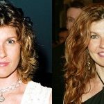 Connie Britton Plastic Surgery Before and After