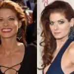 Debra Messing Plastic Surgery Before and After