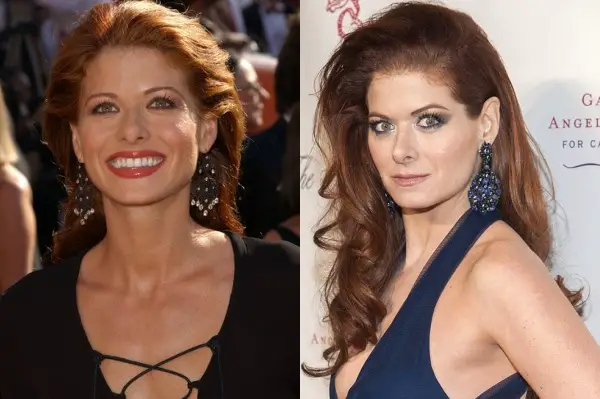 Debra Messing Plastic Surgery Before and After - Celebrity Sizes