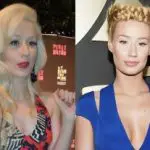 Iggy Azalea Plastic Surgery Before and After