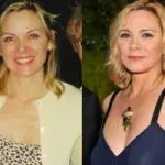 Kim Cattrall Plastic Surgery Before and After