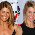 Lori Loughlin Plastic Surgery Before and After