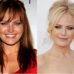 Malin Åkerman Plastic Surgery Before and After