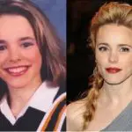 Rachel McAdams Plastic Surgery Before and After