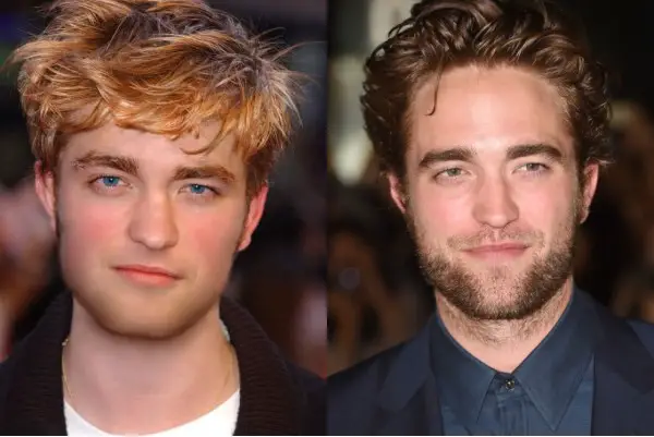 Robert Pattinson Plastic Surgery Before and After - Celebrity Sizes