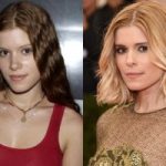 Kate Mara Plastic Surgery Before and After