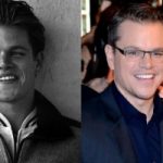 Matt Damon Plastic Surgery Before and After