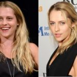 Teresa Palmer Plastic Surgery Before and After