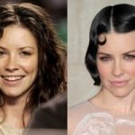 Evangeline Lilly Plastic Surgery Before and After