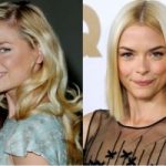 Jaime King Plastic Surgery Before and After