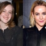 Jena Malone Plastic Surgery Before and After