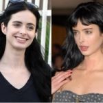 Krysten Ritter Plastic Surgery Before and After