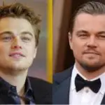 Leonardo DiCaprio Plastic Surgery Before and After
