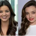 Miranda Kerr Plastic Surgery Before and After