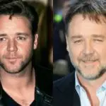 Russell Crowe Plastic Surgery Before and After