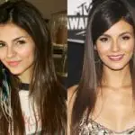 Victoria Justice Plastic Surgery Before and After