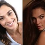 Gal Gadot Plastic Surgery Before and After