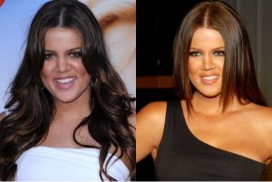 Khloe Kardashian 