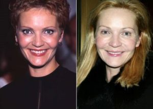 Joan Allen 