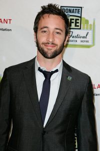 Alex O'Loughlin